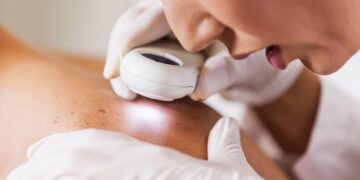 A Guide For The 60 Plus Crowd: Choosing The Right Skin skin cancer practitioners