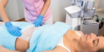 Neck Lift with Chin Liposuction
