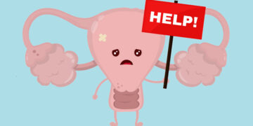 Endometriosis