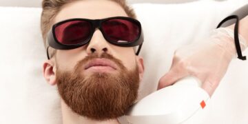 Laser Hair Removal