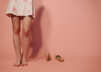 The Ultimate Guide to Varicose Vein Treatments for Optimized Wellness