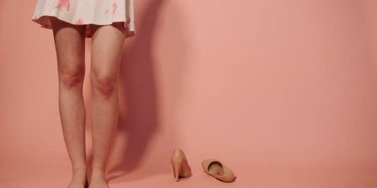 The Ultimate Guide to Varicose Vein Treatments for Optimized Wellness