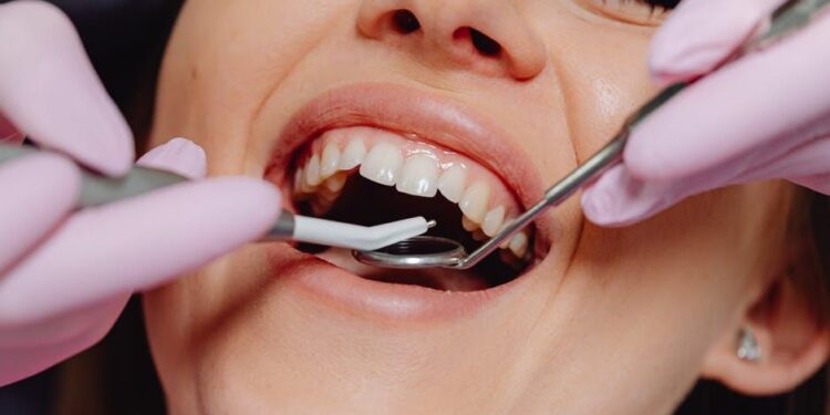 Dental Procedures