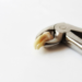 The Ultimate Guide to Tooth Extraction: What You Should Know Beforehand