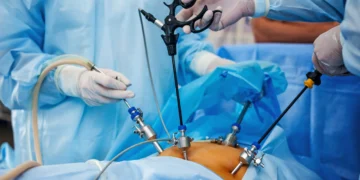 Endoscopy