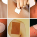 Transdermal Skin Patches: Advancing Convenient and Effective Drug Delivery