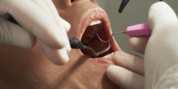 Dental Pain