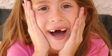 Tooth Replacement