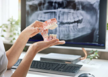 Building Confidence Brick by Brick: The Role of Implants in Modern Dentistry