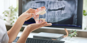 Building Confidence Brick by Brick: The Role of Implants in Modern Dentistry
