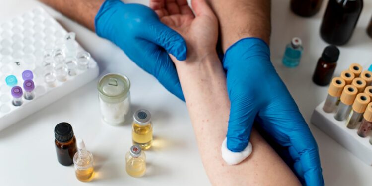 Mastering Wound Management: Essentials of Effective Wound Dressing Products