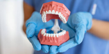 Top 5 Factors That Affect the Price of a Dental Crown