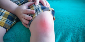 can a swollen knee be dangerous