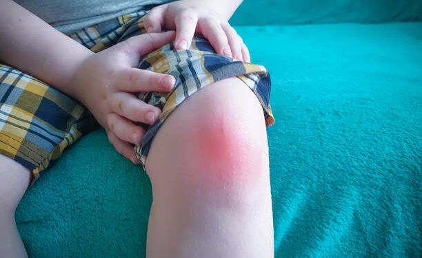 can a swollen knee be dangerous