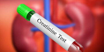 is creatinine level 1.7 dangerous