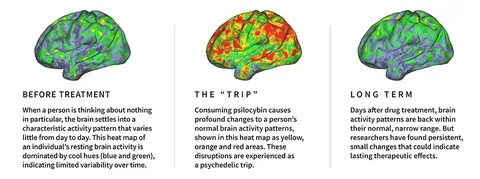Psilocybin Relapse Prevention: Next-Gen Alcohol Treatment Debate